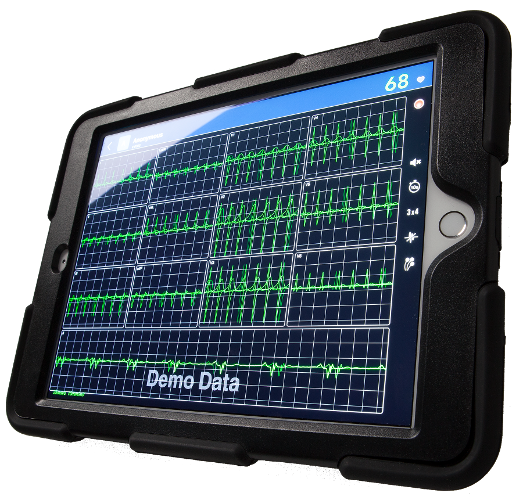 Met de Heart-app kan een elektrocardiogram worden gemaakt dat digitaal naar een arts wordt gestuurd. (Foto MedAssist.online)